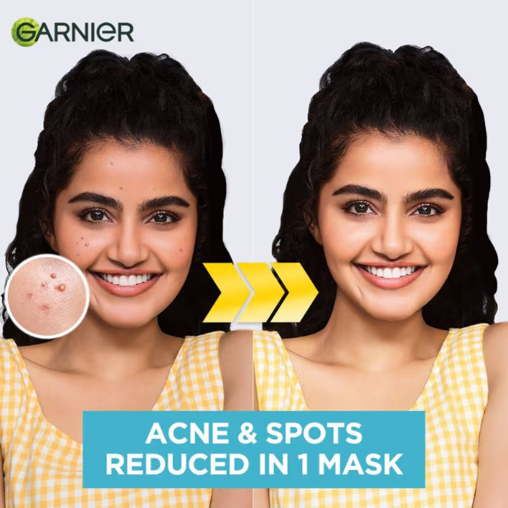 Garnier Bright Complete Anti Pimple Sheet Mask With Salicylic Acid, Niacinamide & Vitamin C Serum