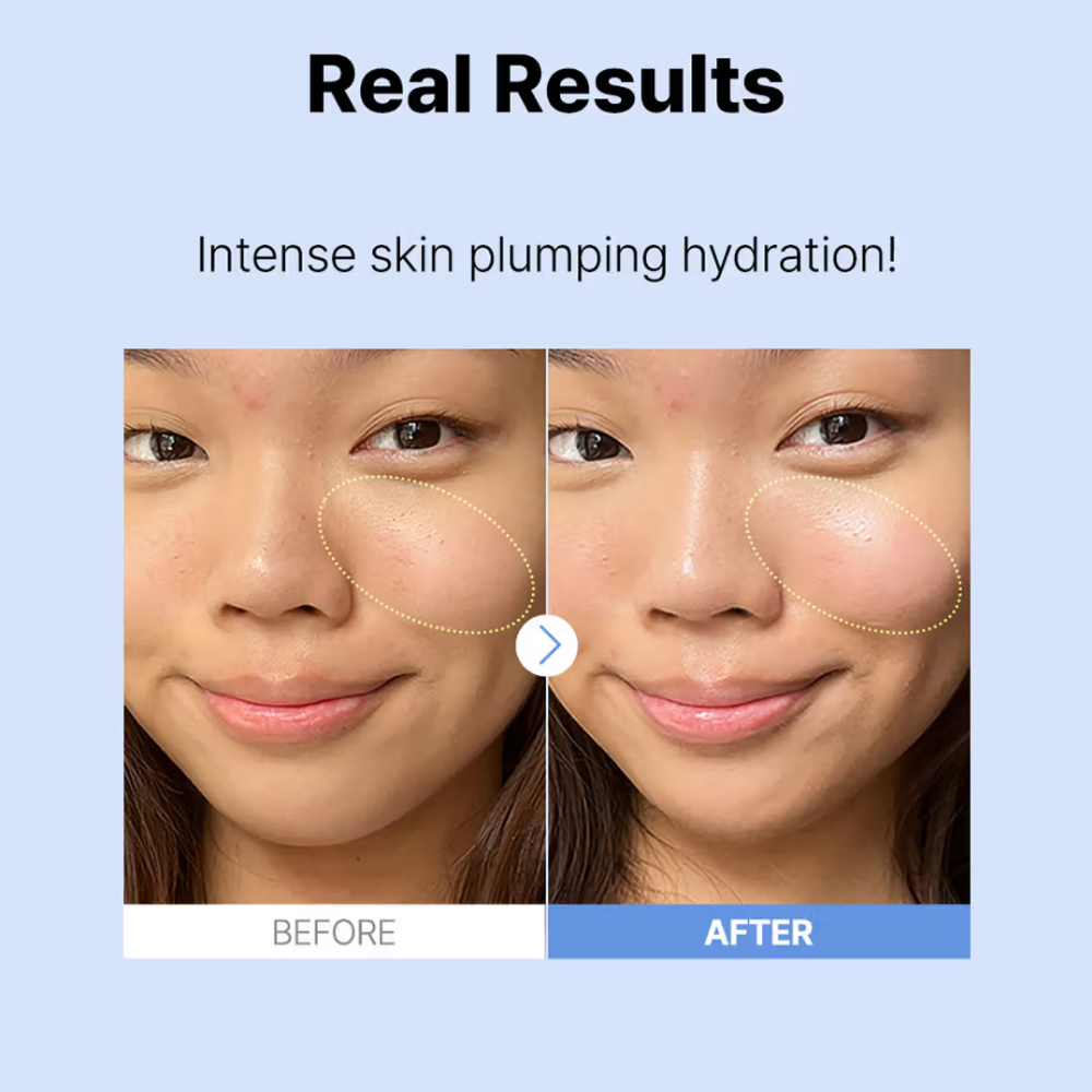 COSRX The Hyaluronic Acid 3 Serum