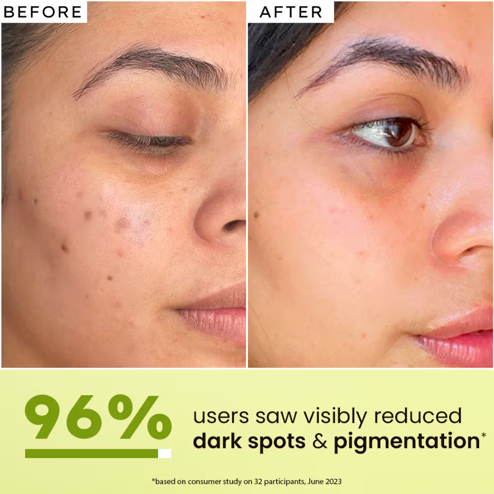 Hyphen Golden Hour Glow Serum 56% Glow Hyphened All Skin Types