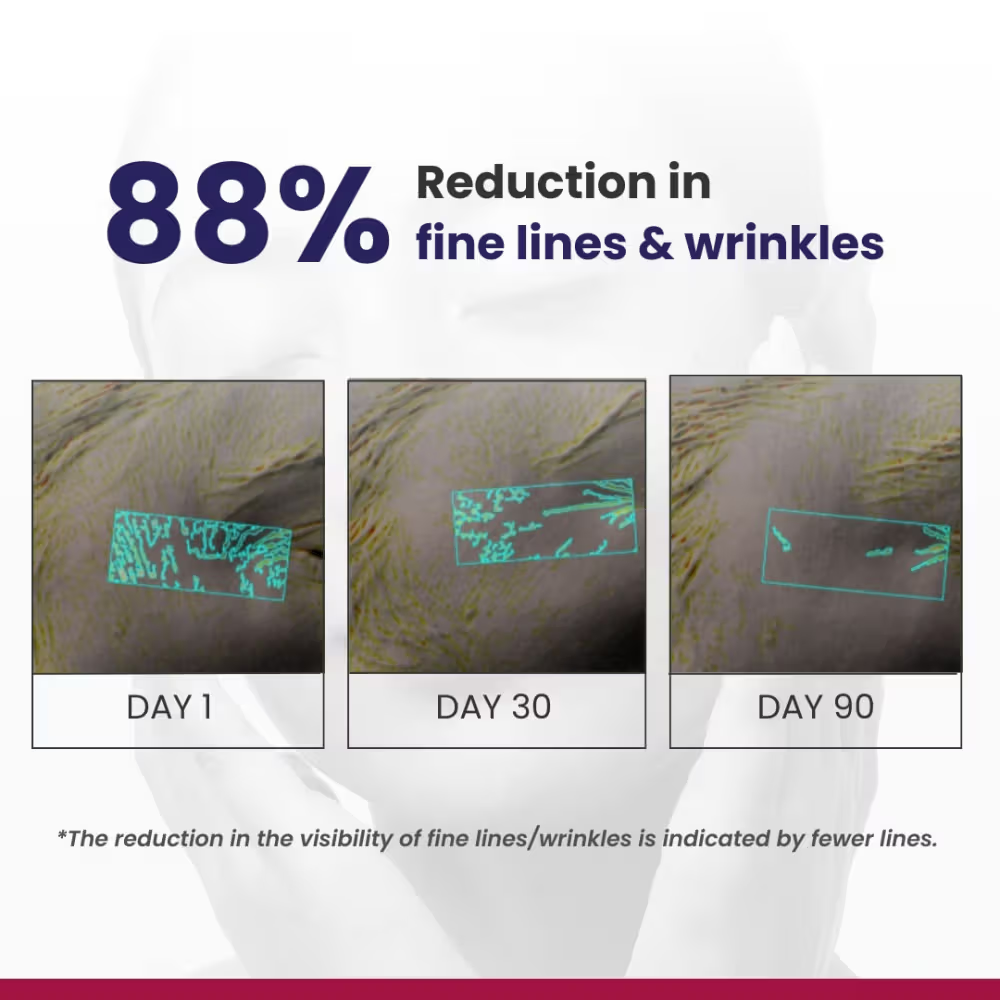 Reequil 0.1% Retinol Night Creamtreat For Wrinkles & Skin Tightening