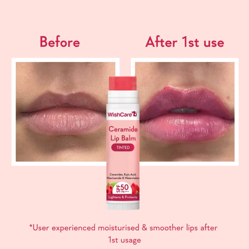 Wishcare Tinted Ceramide Lip Balm with SPF50 PA+++ - Kojic Acid & Niacinamide - For Lip Lightening
