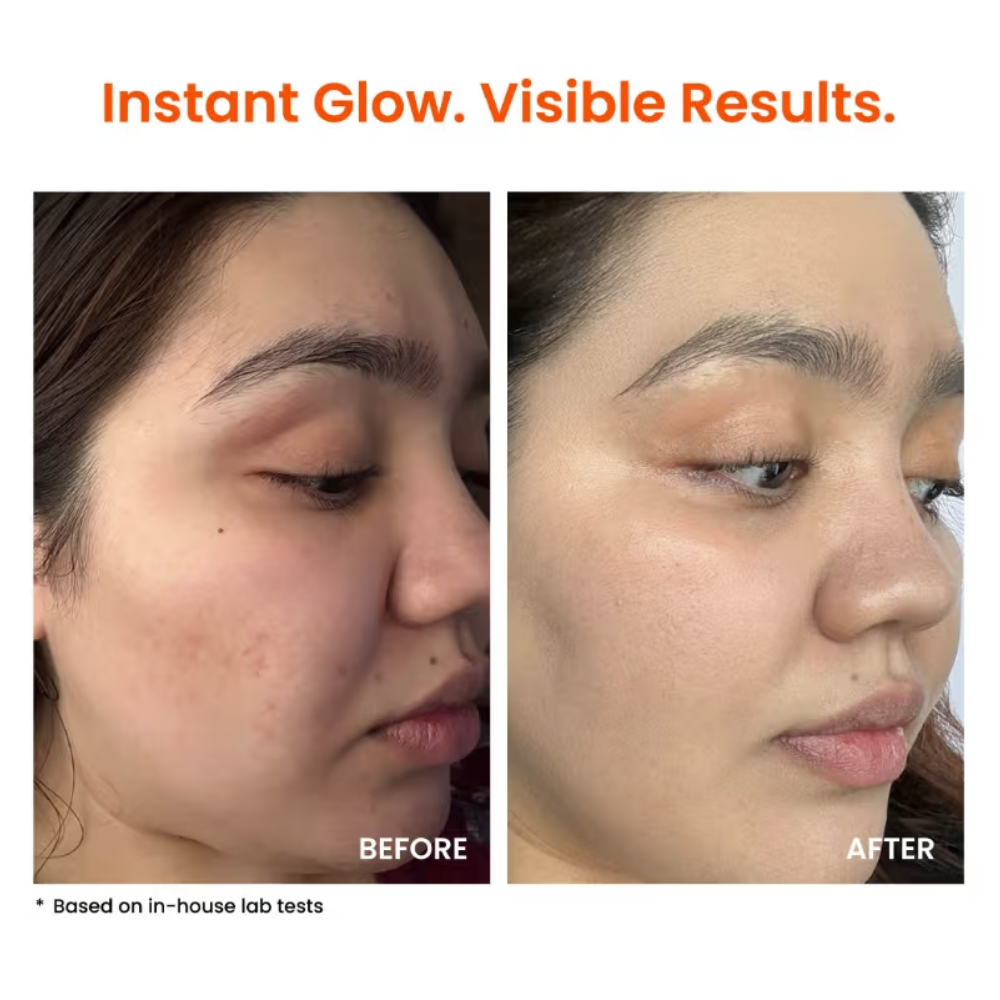 Foxtale Super Glow Moisturizer with Vitamin C & Niacinamide For Dull, Pigmented & Uneven Skin