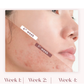 Seoulskin Red Serum (Niacinamide 5 +TXA 3)
