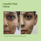 Plum Green Tea Pore Cleansing Gel Face Wash With Glycolic Acid - Fights Acne & Oil For Clear Skin