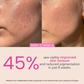 O3+ Night Repair Cream - Moisturiser For Brightening & Glow Boosting | Fades Finelines & Wrinkles