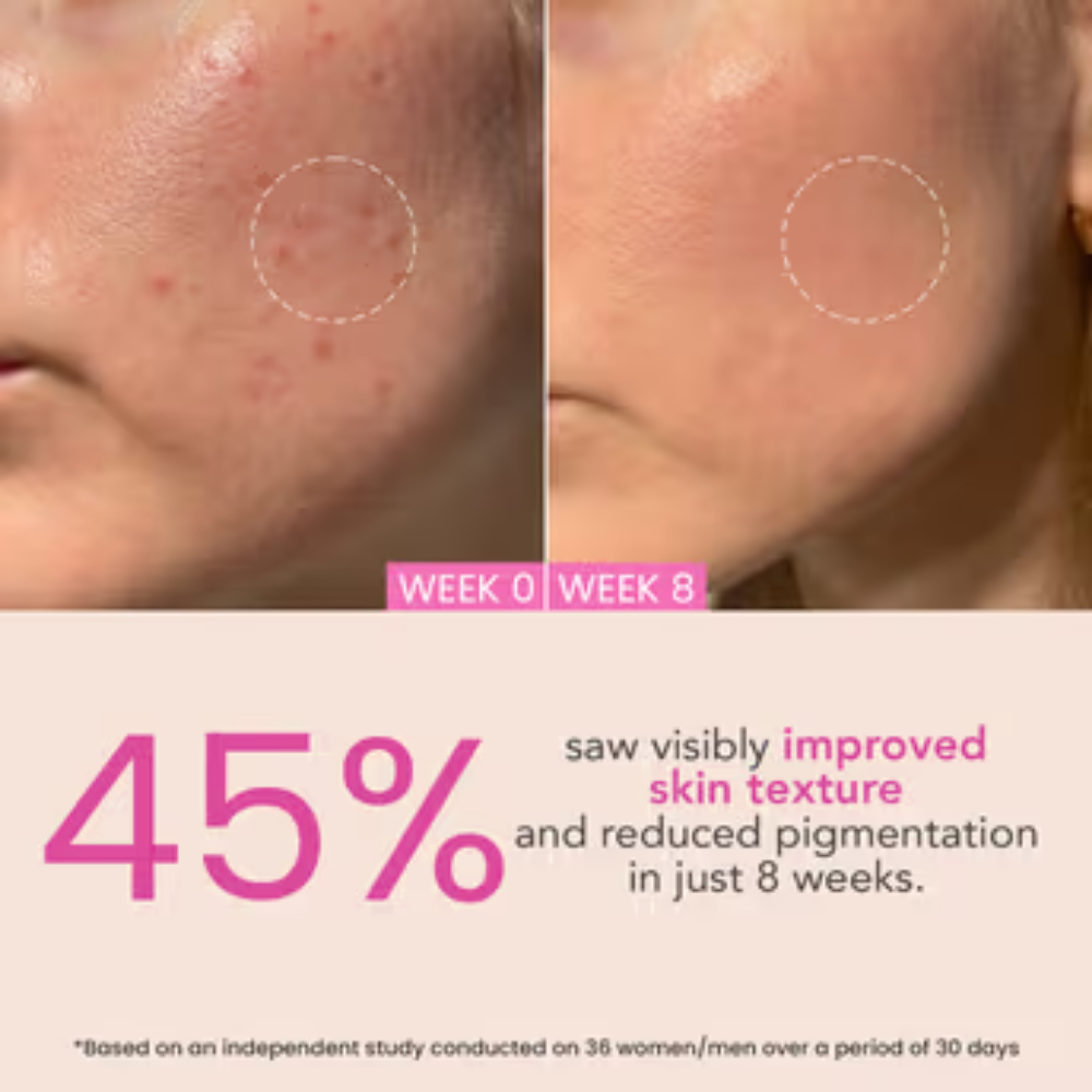 O3+ Night Repair Cream - Moisturiser For Brightening & Glow Boosting | Fades Finelines & Wrinkles