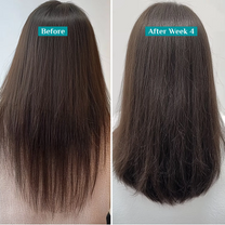 Pilgrim Redensyl & Anagain Hairfall Control Shampoo