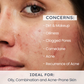 Hyphen Oil Control Daily Exfoliating Cleanser 2% AHA + BHA Salicylic Acid Face Wash For Oily Skin & Acne