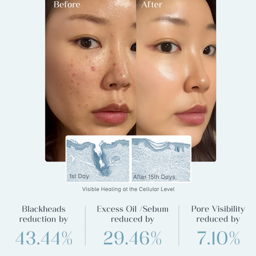 Seoulskin Zero Pore Pads