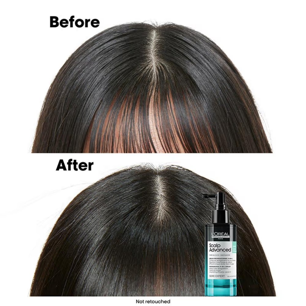 L'Oréal Professionnel Scalp Advanced 5-in-1 Professional Leave-in Serum for Scalp Care