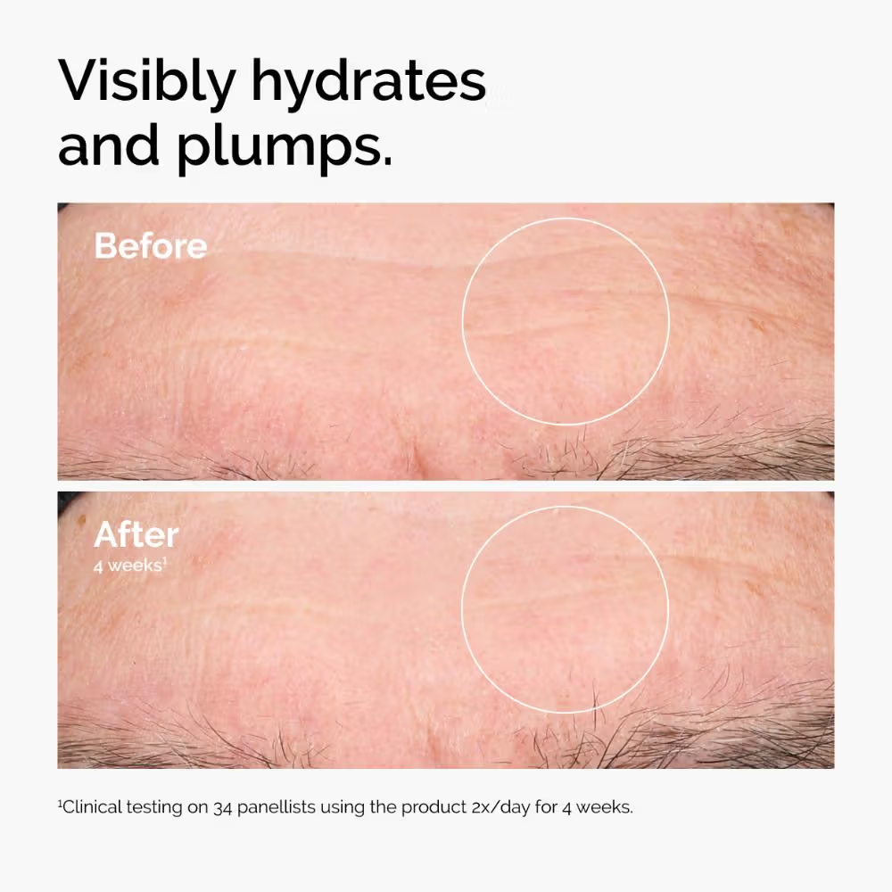 The Ordinary Hyaluronic Acid 2% + B5