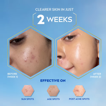 Nivea Luminous Even Glow Oil Control Serum