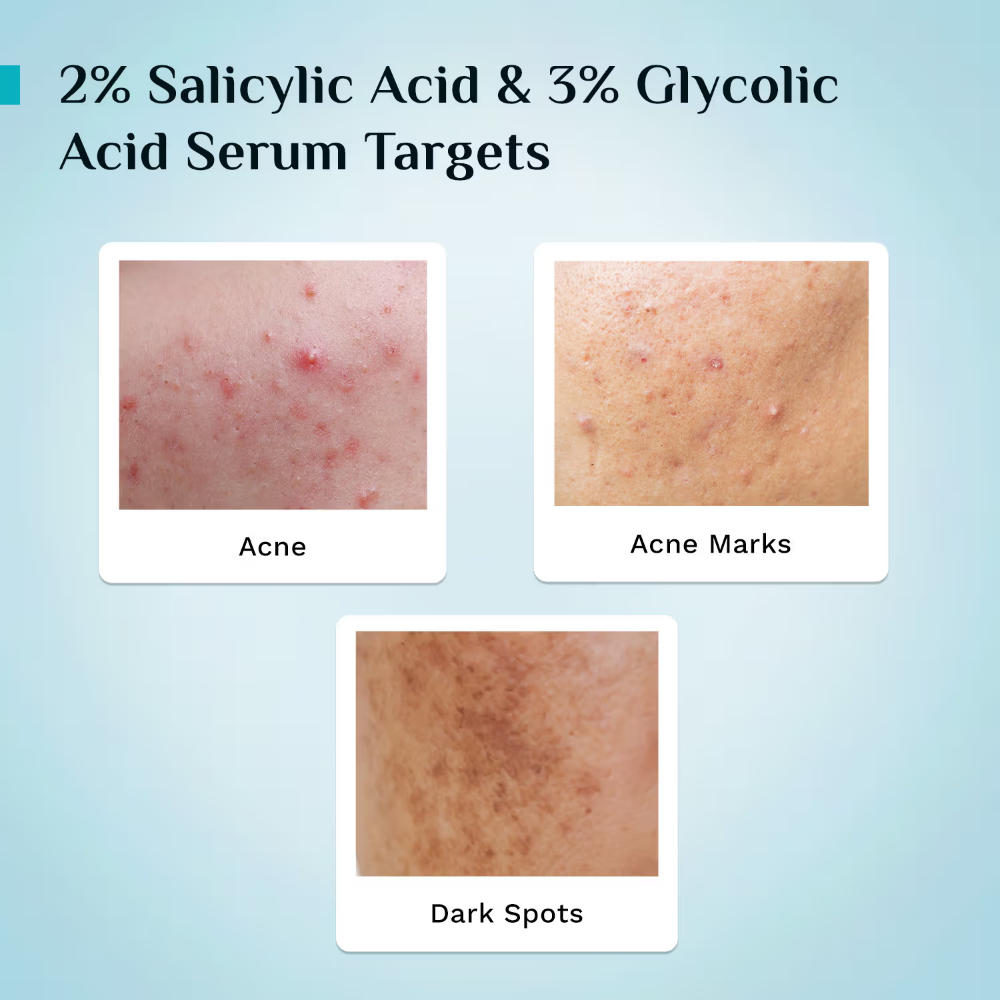 Pilgrim Salicylic & Glycolic Acid Anti Acne Serum