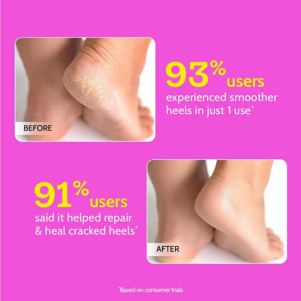 Chemist At Play Foot Roll-on Repairs & Heals Cracked Heels Upto 24-Hours Moisturization