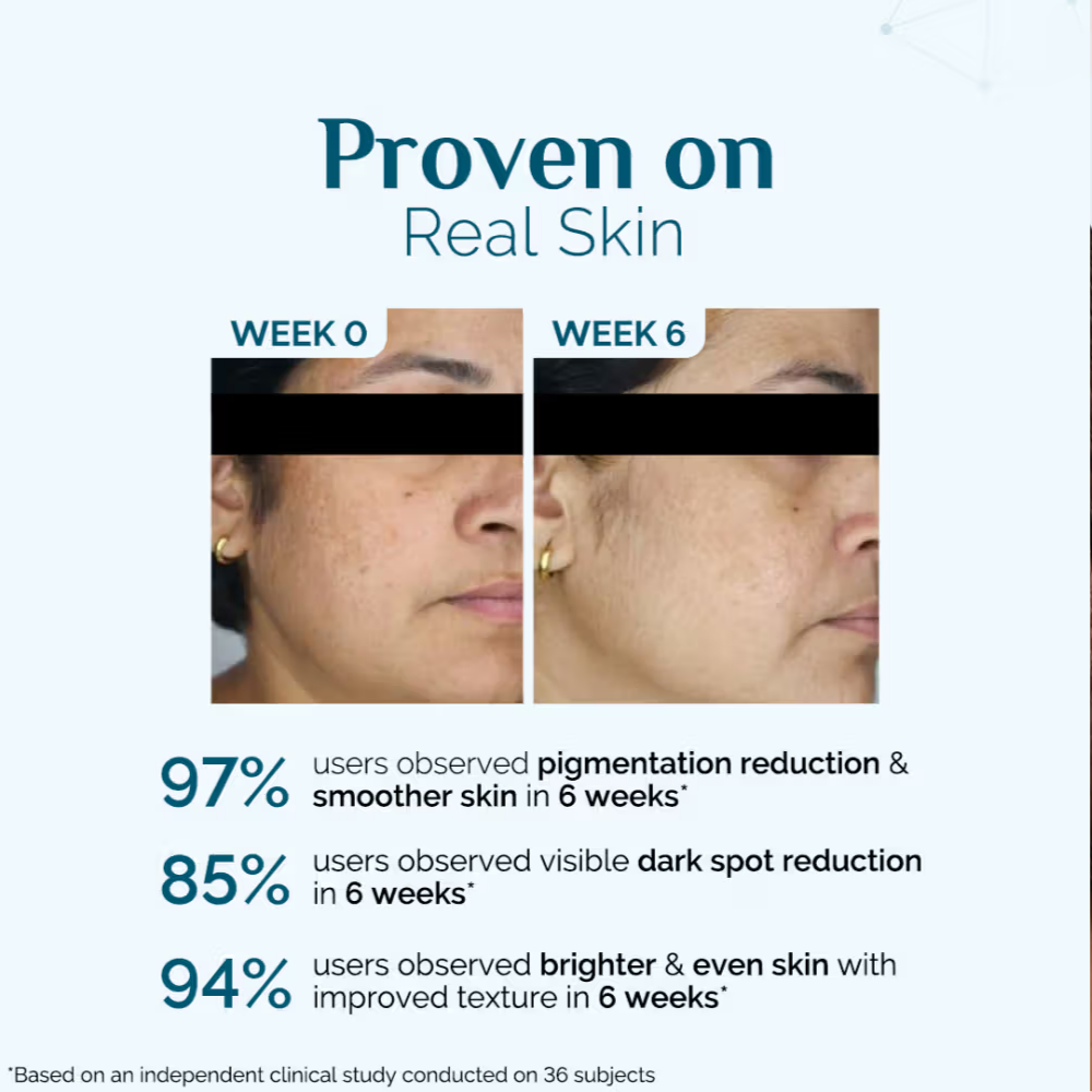 The Derma Co X Dr. V Skin Renew Hyperpigmentation Peptide Serum