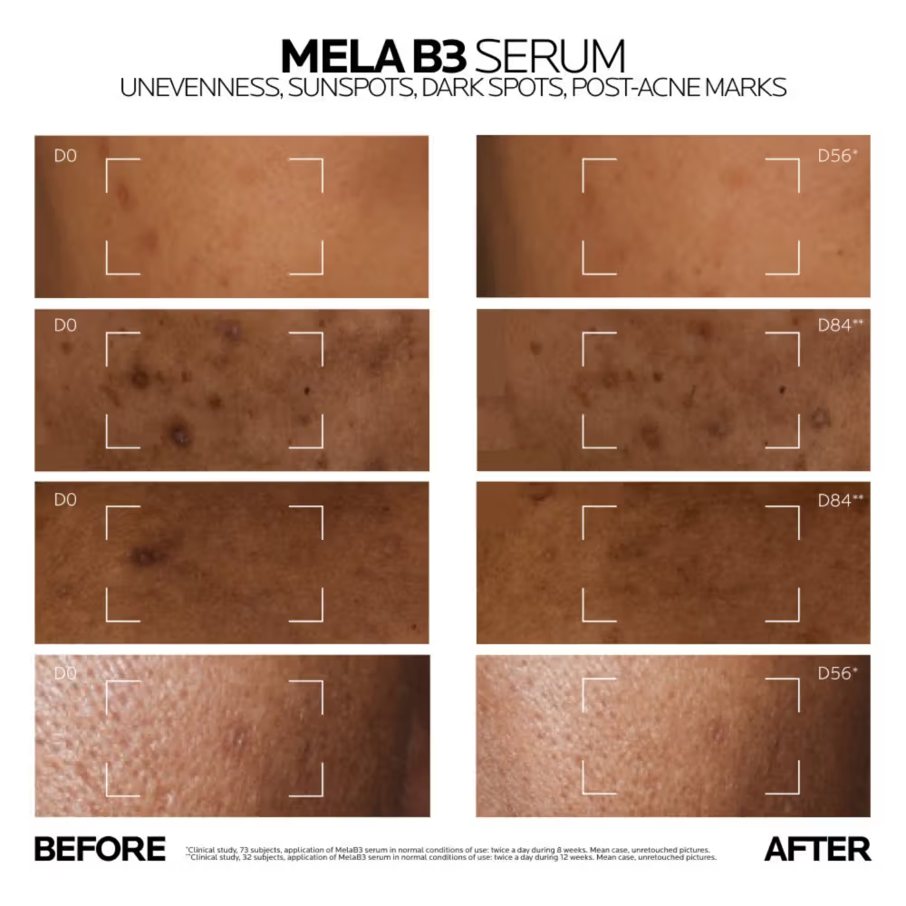 La Roche-Posay Mela B3 Serum
