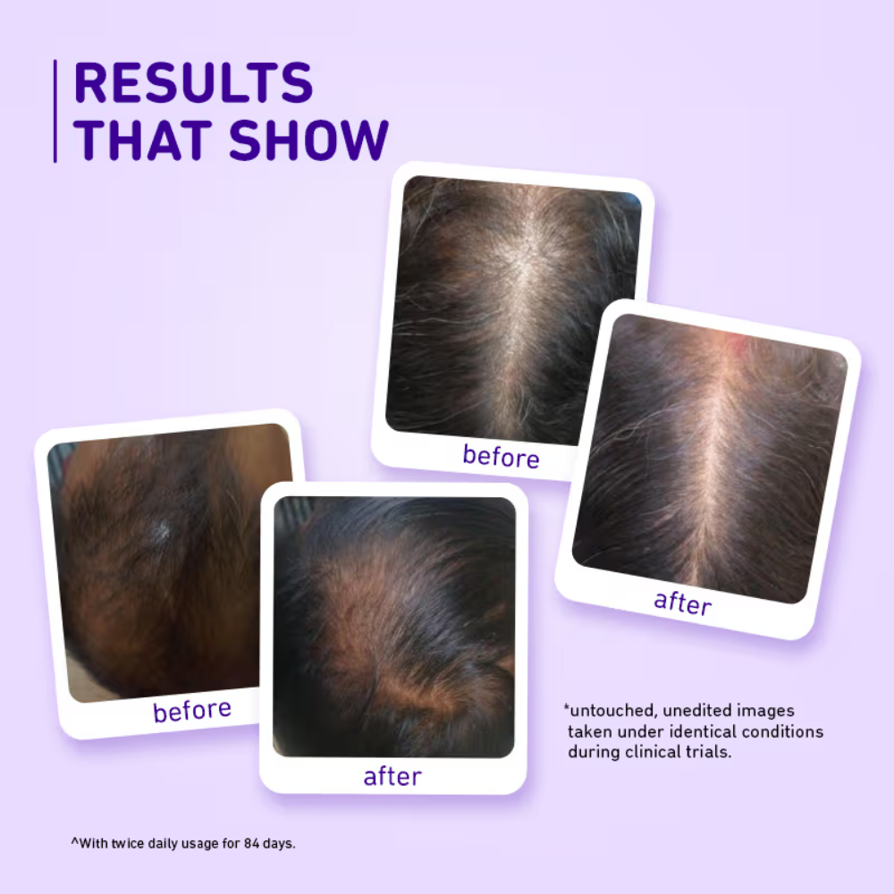 Plum Rosemary & 3% Redensyl Hair Growth Serum