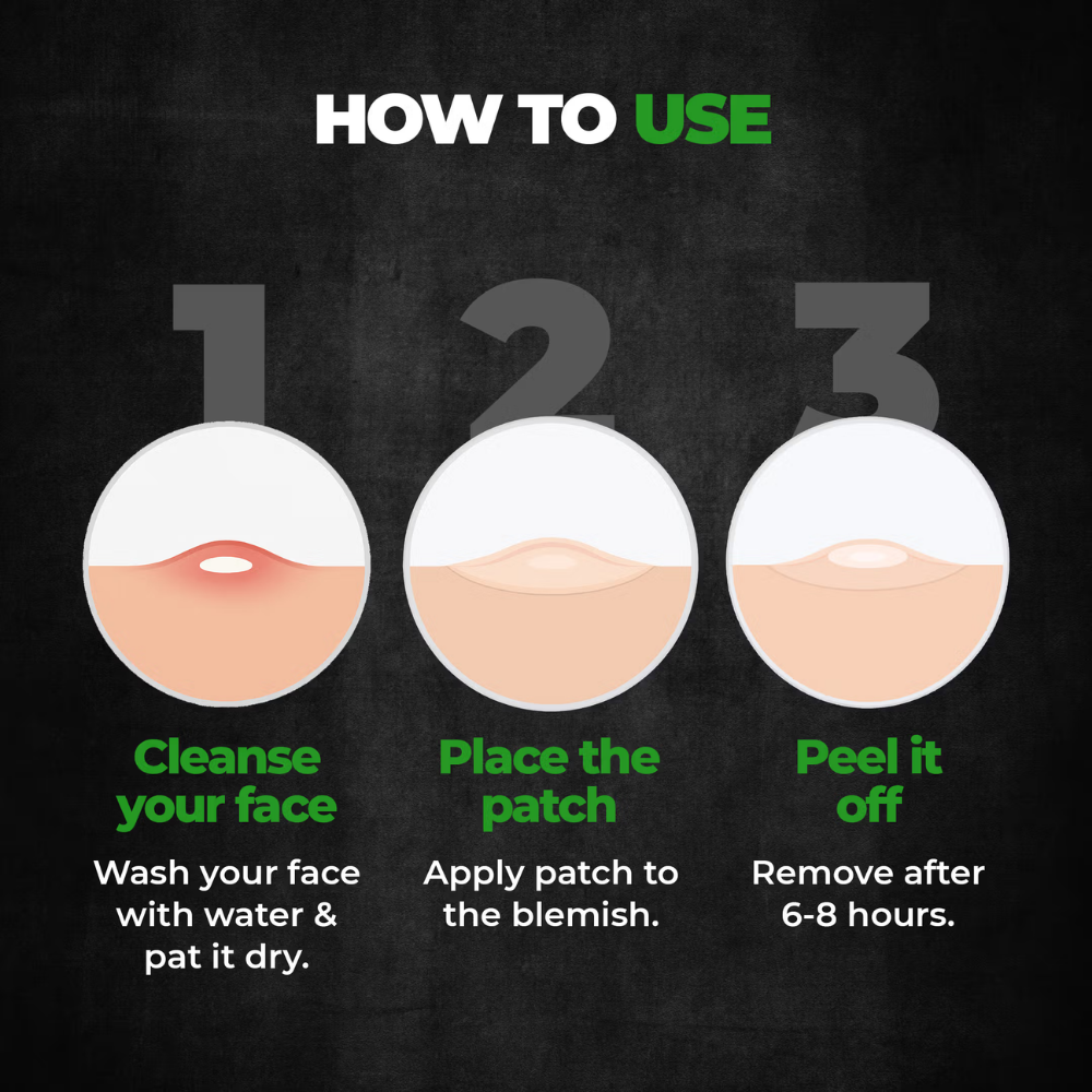 Beardo Acne Pimple Patch