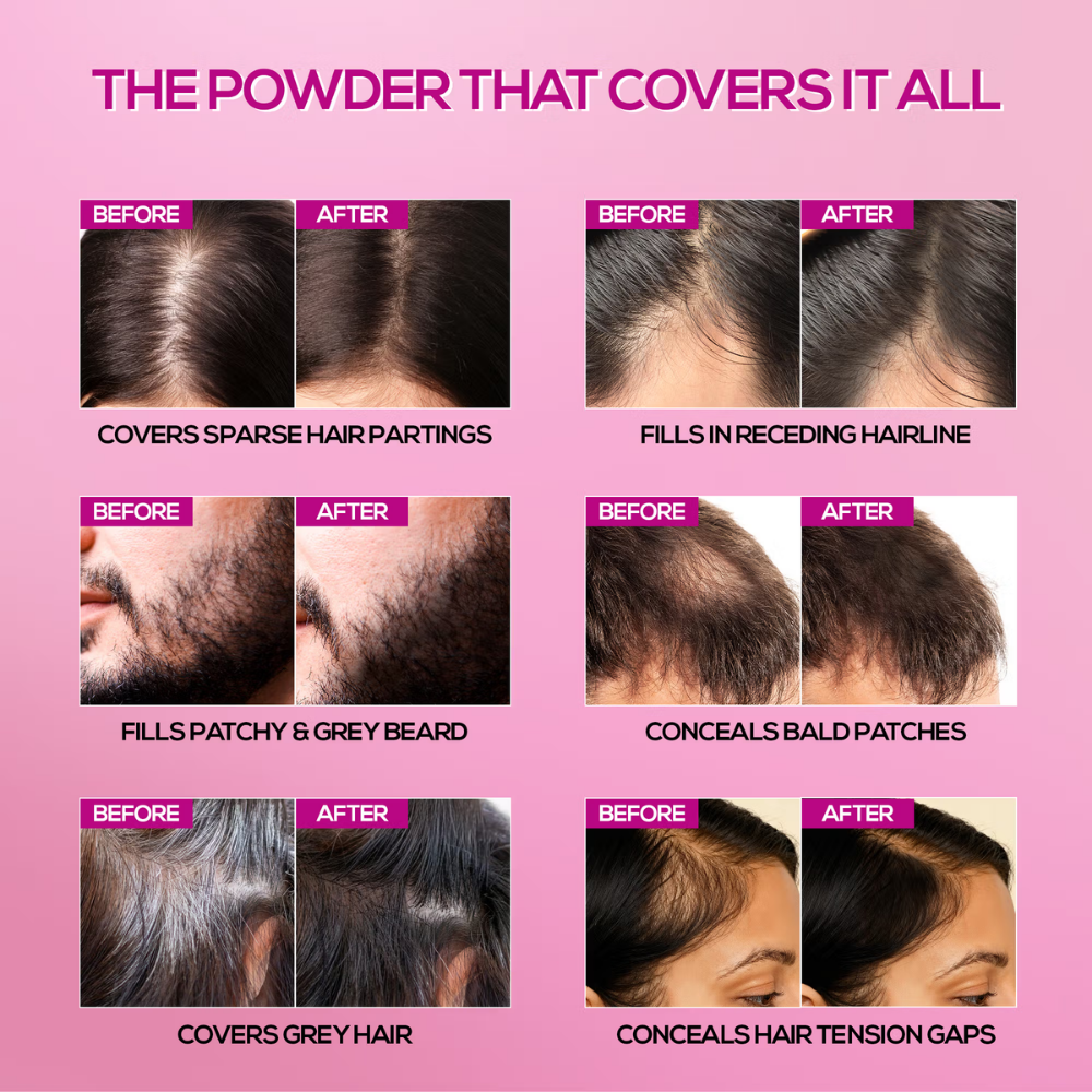 RENEE Cover-Up Hair Powder For Men & Women, For Instant Grey Hair Coverage & Root Touch-Up