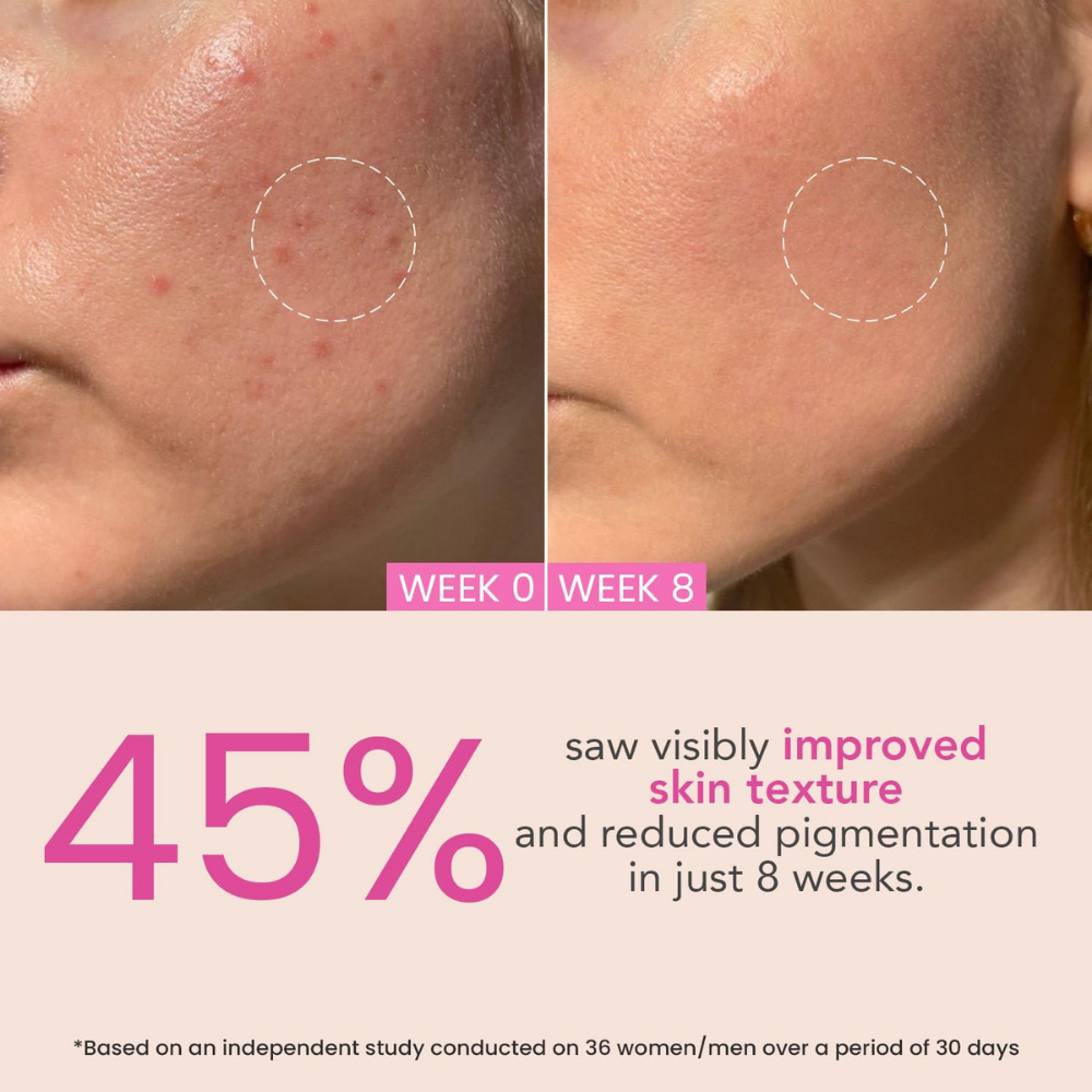 O3+ Anti Tan With Night Cream