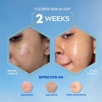 Nivea Luminous Even Glow Oil Control Day Cream Spf 50,Thiamidol Uv Protection & Reduces Dark Spots