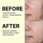 Celimax The Vita-A Retinal Shot Tightening Booster, For Anti-Aging, Dark Spots & Wrinkles
