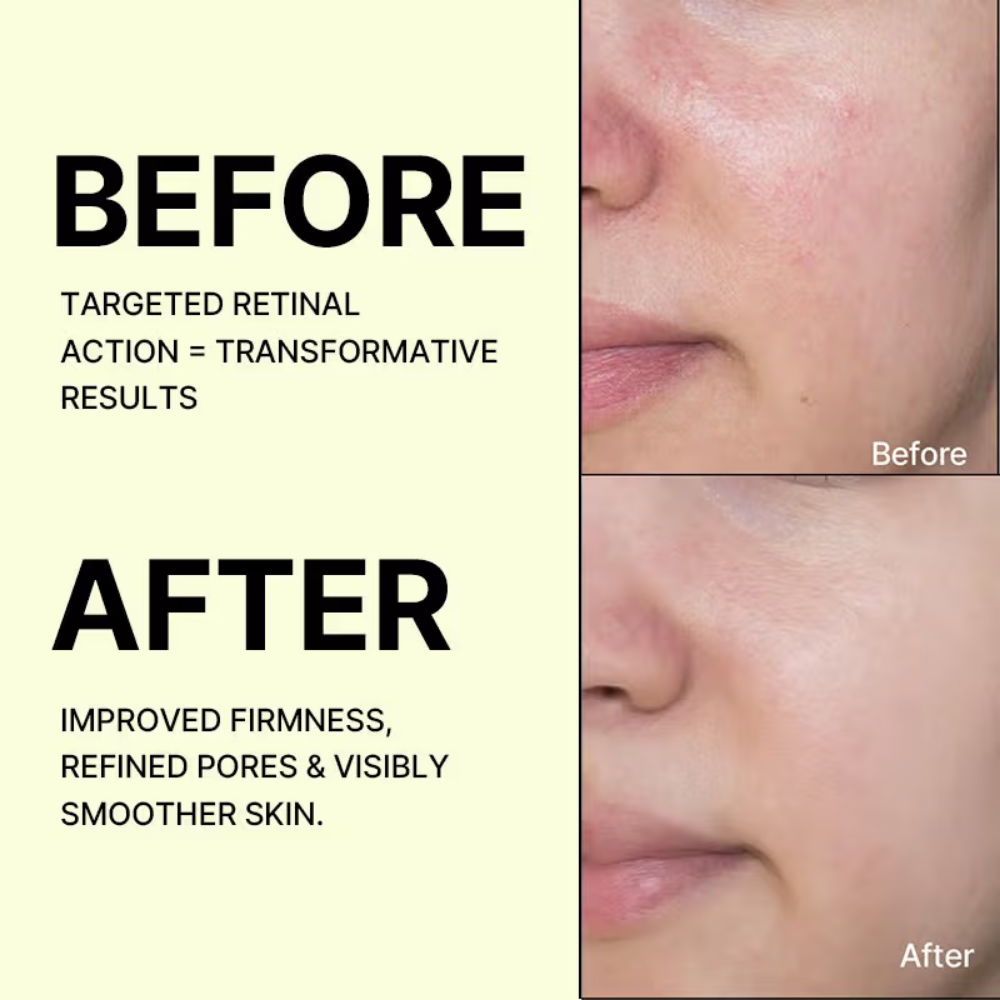 Celimax The Vita-A Retinal Shot Tightening Booster, For Anti-Aging, Dark Spots & Wrinkles