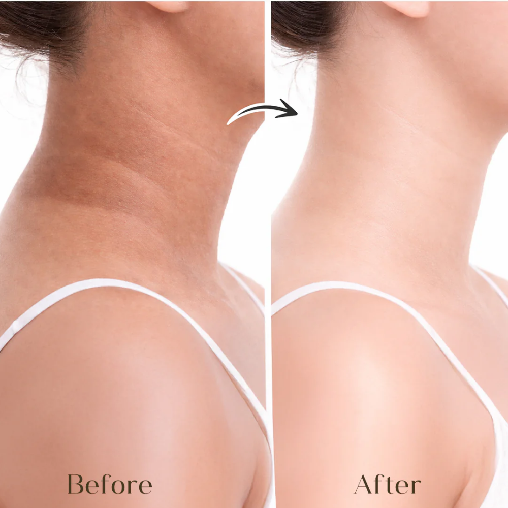 Seoulskin Kojic & Rice Water Brightening Soap