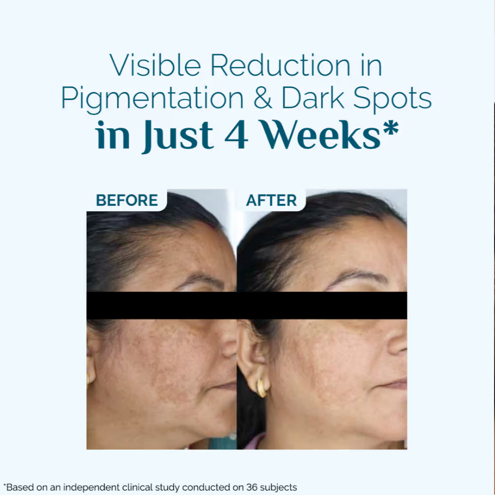 The Derma Co X Dr. V Skin Renew Hyperpigmentation Peptide Serum