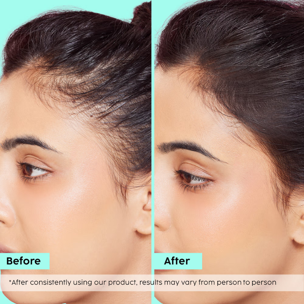 Plix Rosemary Hair Growth Advanced Hair Spray