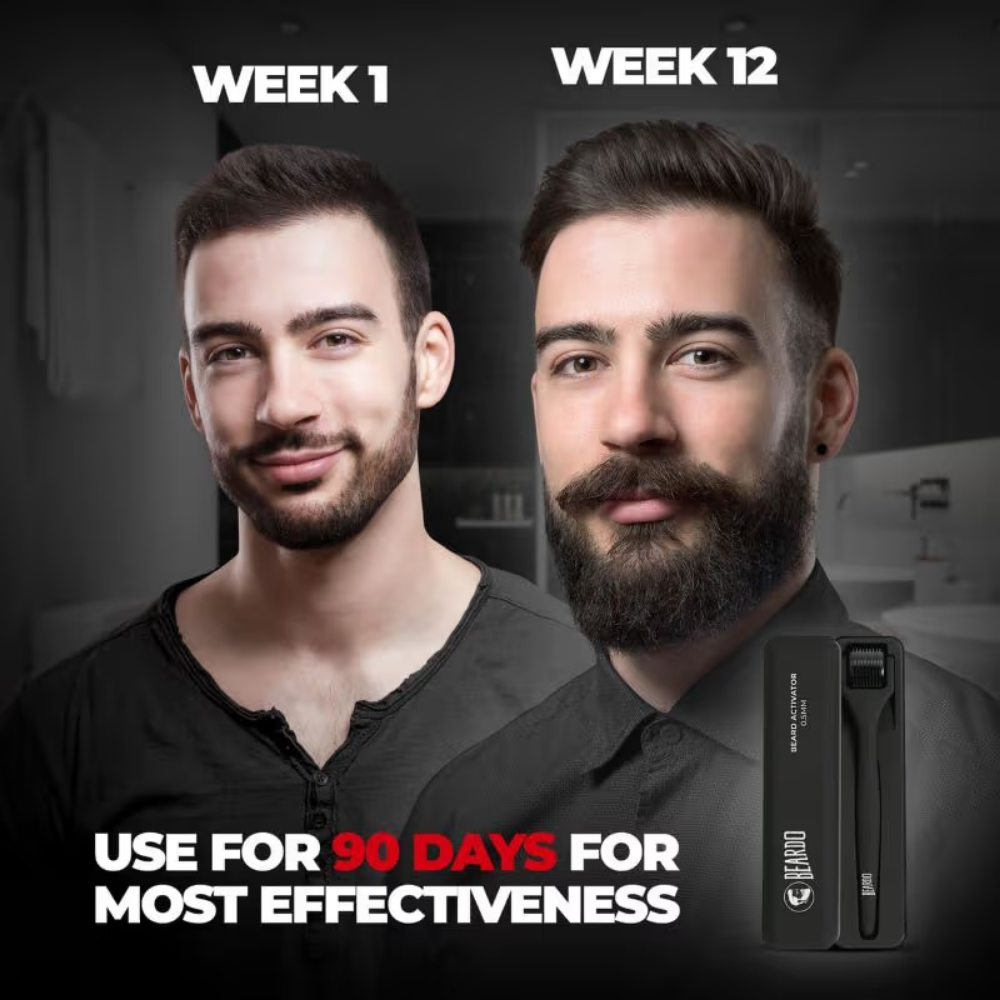 Beardo Beard Activator Derma Roller for Men, 540 - 0.5mm Chromium needles,Stimulates Hair Follicles