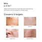 Minimalist 2% Salicylic Acid + LHA Face Cleanser With Zinc For Reducing Sebum & Acne