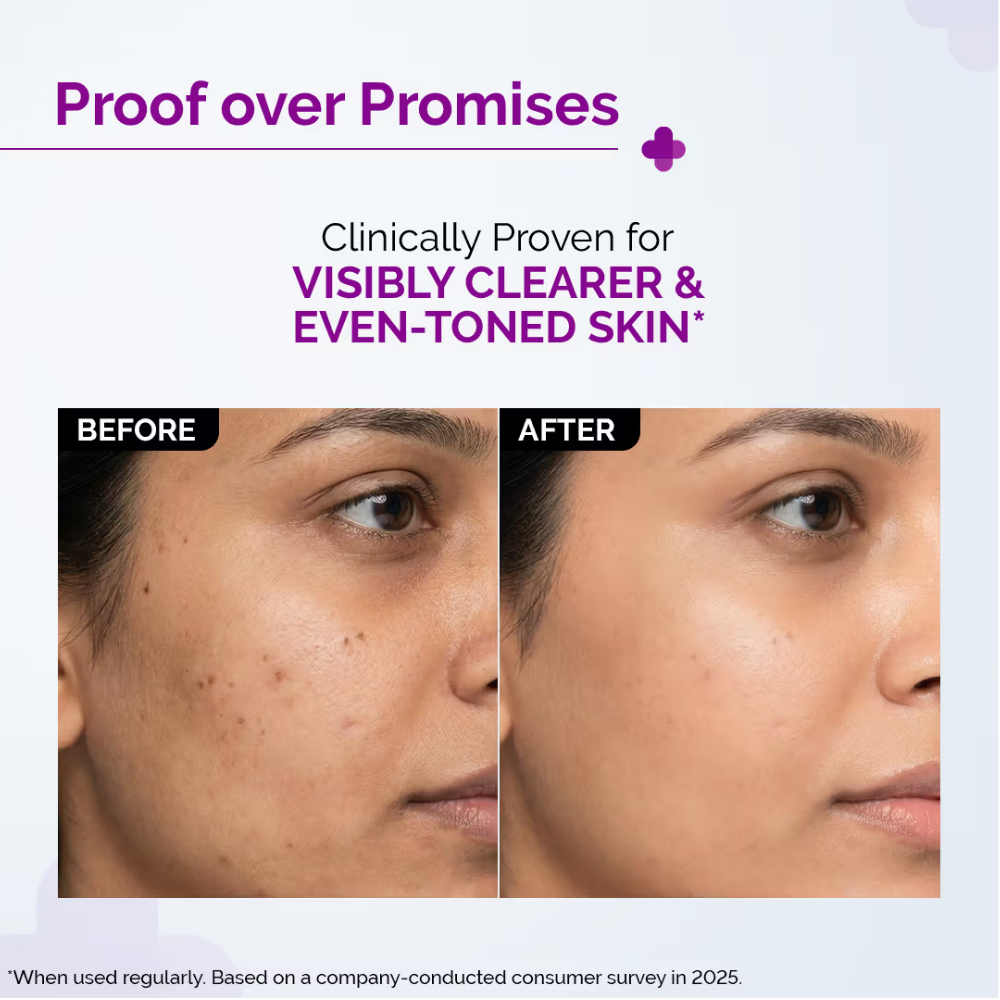 The Derma Co 10% Niacinamide Face Serum For Acne Marks
