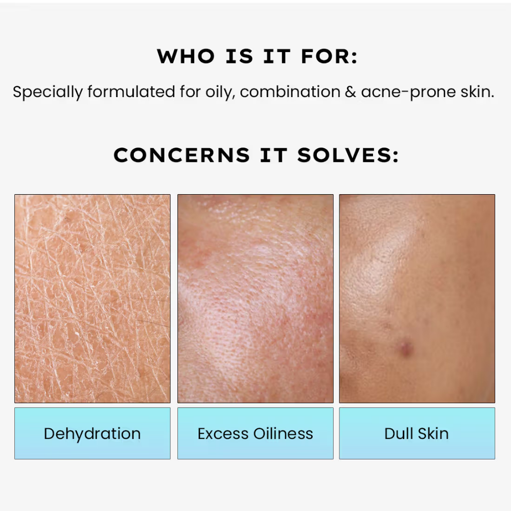 Hyphen 2% Cica Exosome Oil-Free Moisturizer 5% Niacinamide Controls Oil Non-sticky, Light Gel
