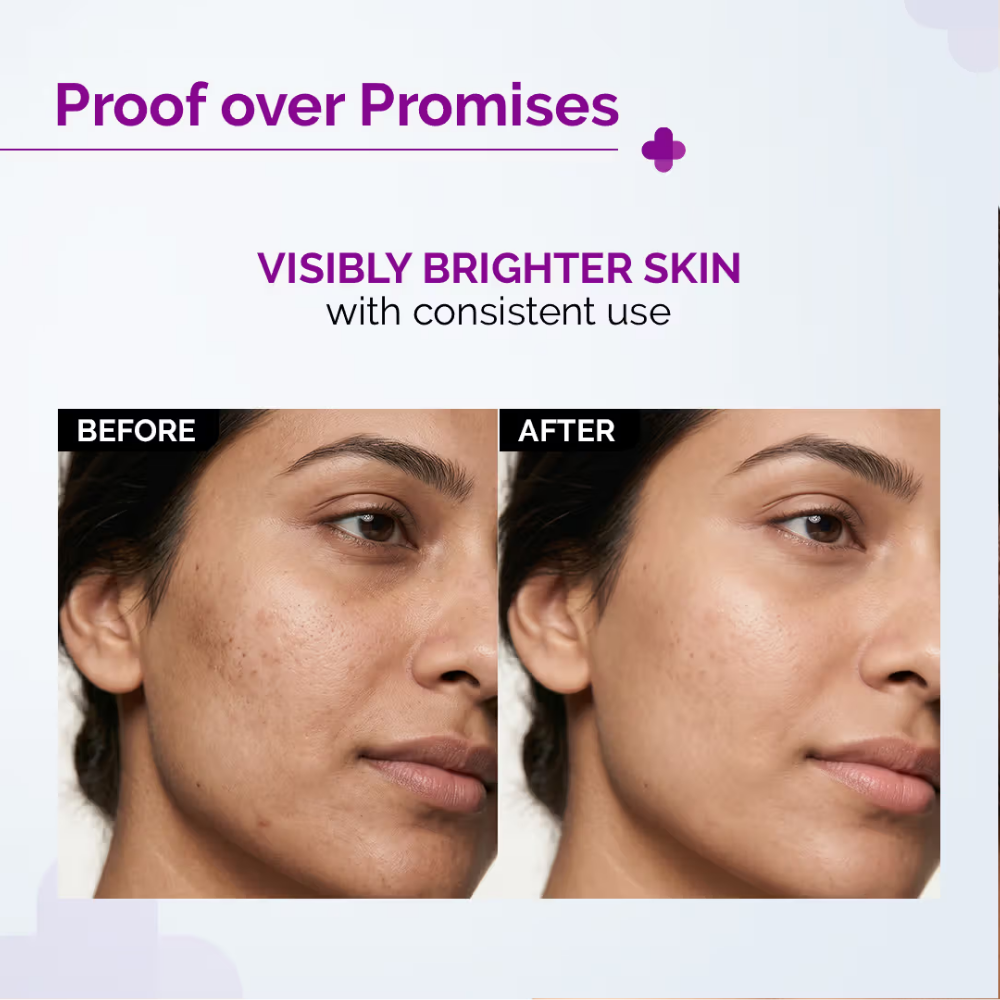 The Derma Co 15% Vitamin C Face Serum