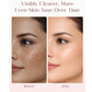 Seoulskin Kojic Acid Skin Lightening Cream