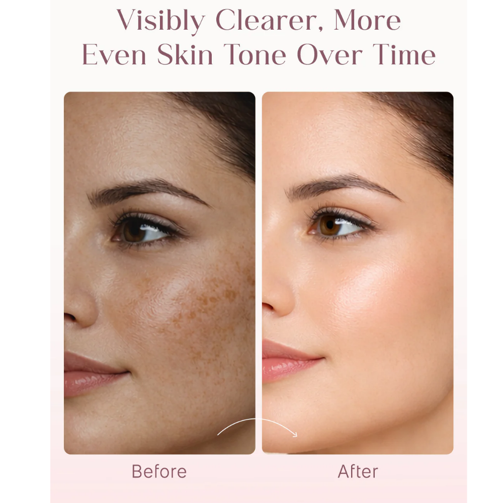Seoulskin Kojic Acid Skin Lightening Cream