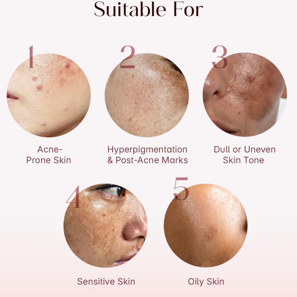 Seoulskin Red Serum (Niacinamide 5 +TXA 3)