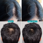 Pilgrim Redensyl & Anagain Advanced Hair Growth Serum