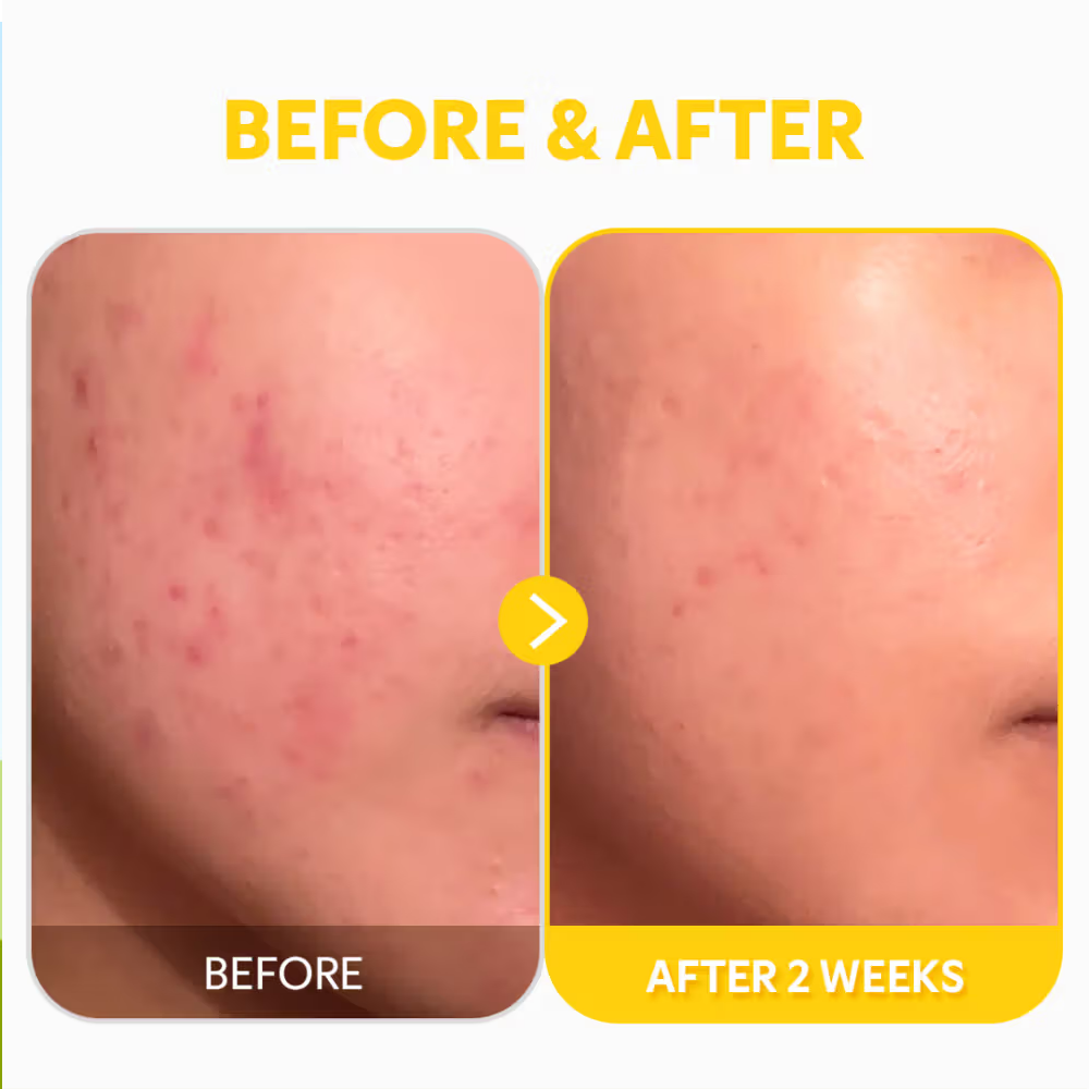 TIRTIR Pure Vitamin C24 Serum