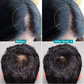 Pilgrim 3% Redensyl & 4% Anagain Advance Hair Growth Serum Roll-On With Rosemary & Korean Black Rice