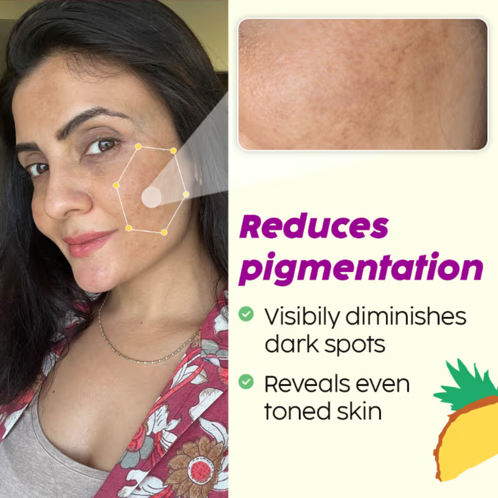 Plix 2% Alpha Arbutin Pineapple Serum for Pigmentation & Dark Spot Reduction