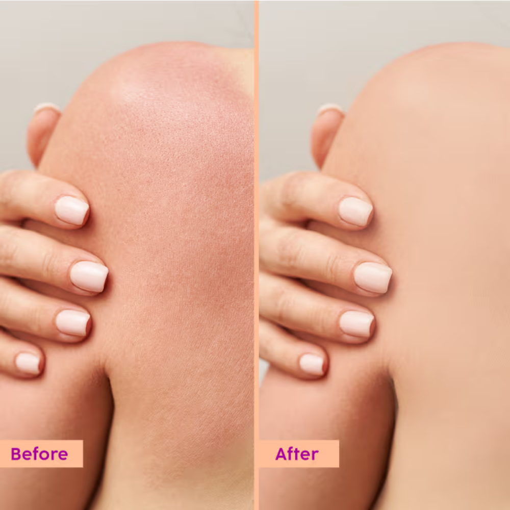 Plix Peaches & Lemon Detan Body Lotion with SPF 30