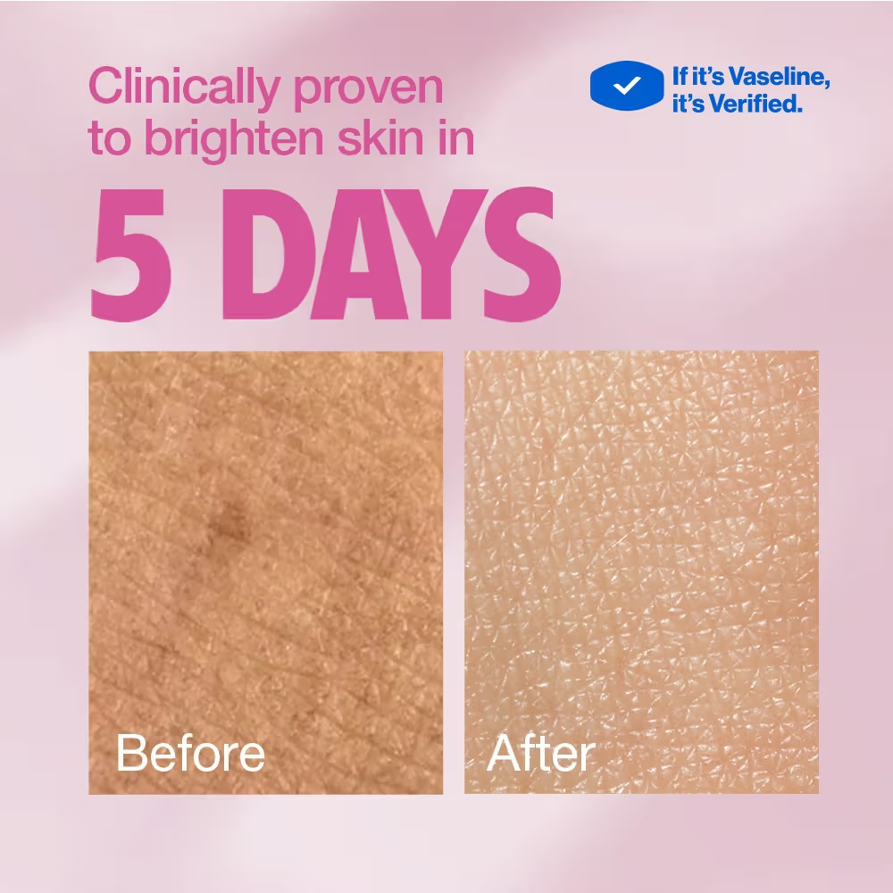 Vaseline Gluta-Hya Dewy Radiance Lotion Bright, Glowing Skin Glutathione Infused Moisturizer